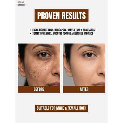 Adonis Unisex Adozelic AZ Face Serum with Azelaic Acid & Niacinamide for Pigmentation & Even Tone