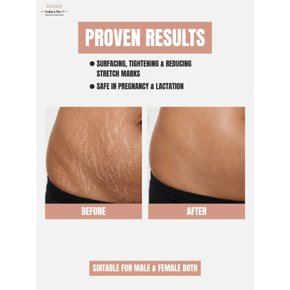 Adonis Stretch Marks Cream with Shea Butter & Vitamin E for Hydrated Smooth Skin