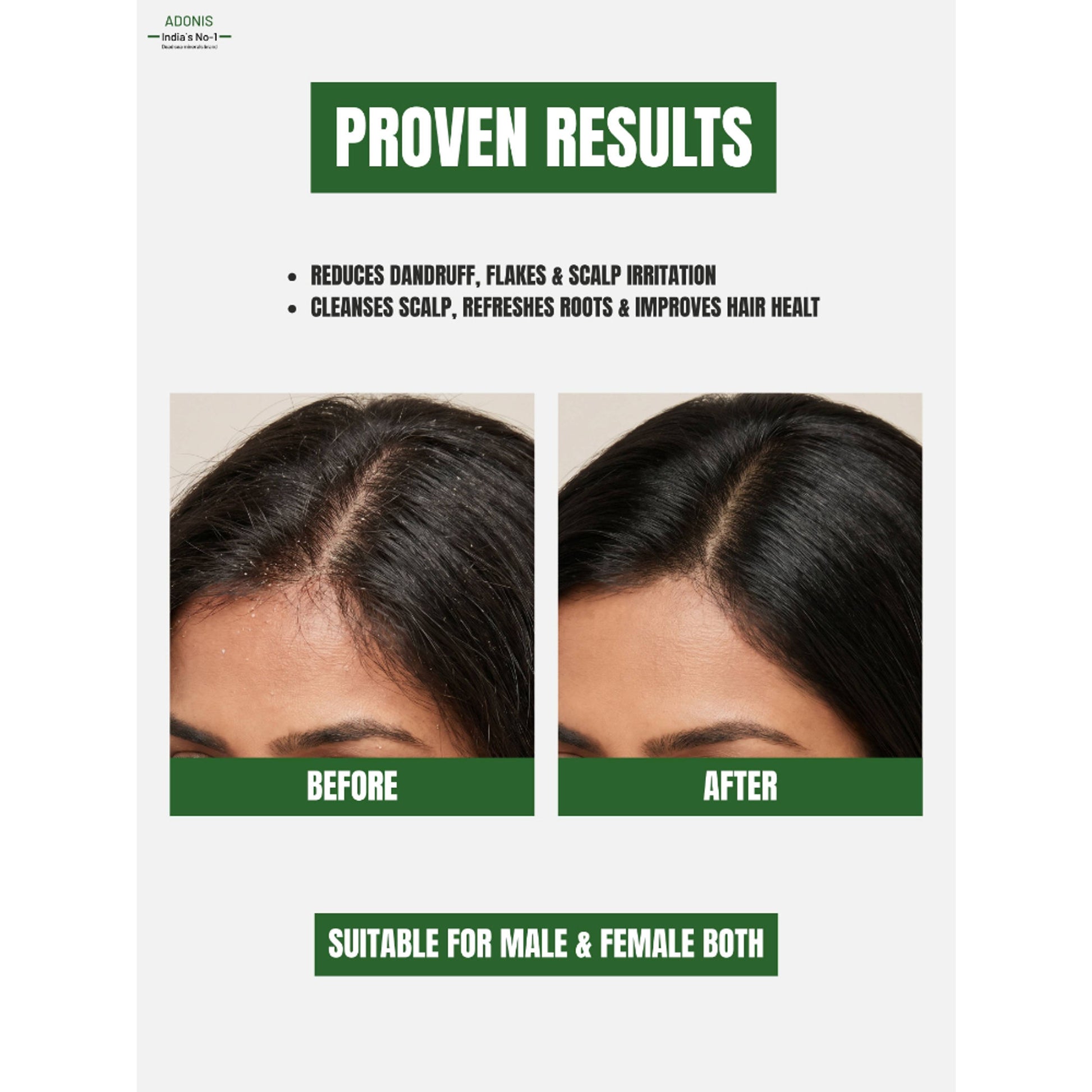 Adonis Grip AD Shampoo With Ketoconazole & Seascalp For Healthy Scalp