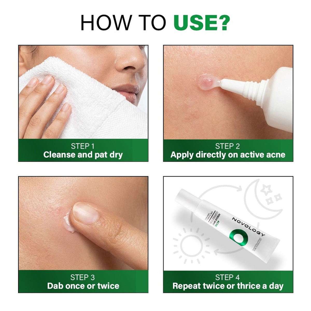 Novology Acne Spot Corrector, For Pimples, Whiteheads, Blackheads, For Sensitive Skin, Dermat Tested