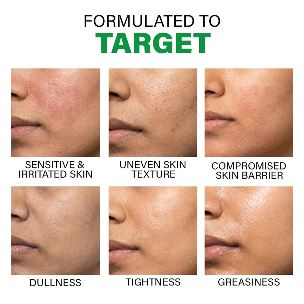 Novology Acne Light Moisturising Gel, Upto 100 Hours of Hydration, Dermat Tested, For Sensitive Skin