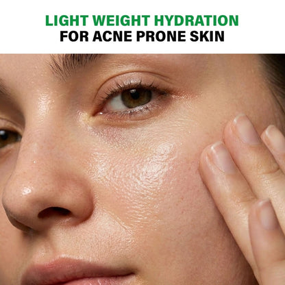 Novology Acne Light Moisturising Gel, Upto 100 Hours of Hydration, Dermat Tested, For Sensitive Skin