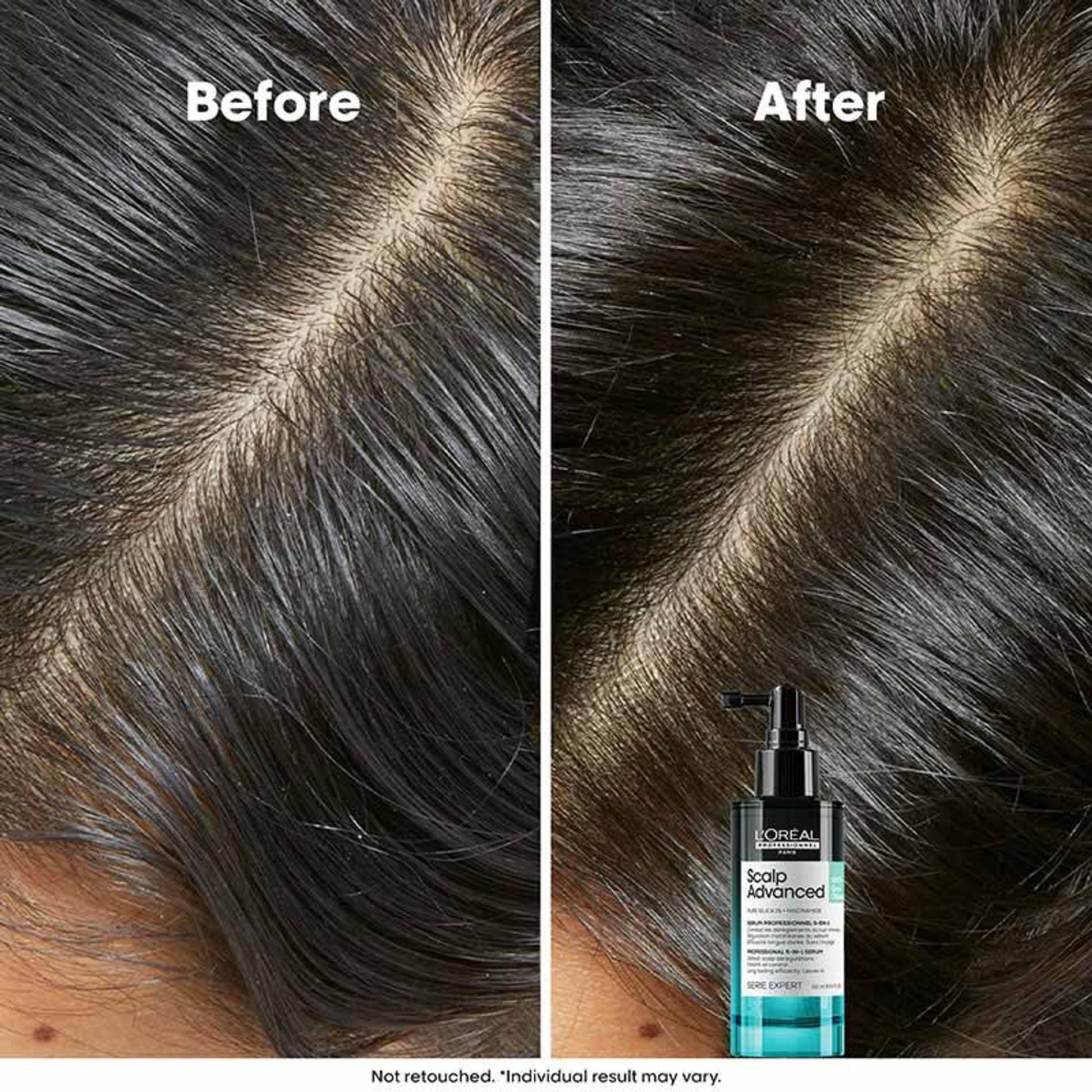 L'Oréal Professionnel Scalp Advanced 5-in-1 Professional Leave-in Serum for Scalp Care