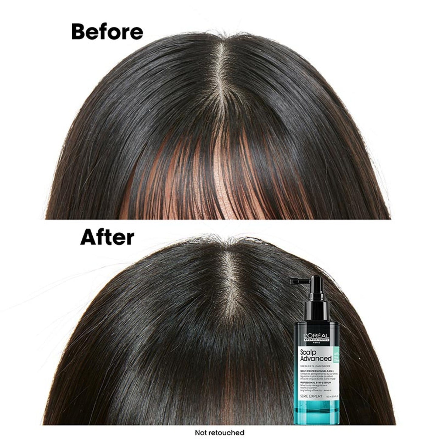 L'Oréal Professionnel Scalp Advanced 5-in-1 Professional Leave-in Serum for Scalp Care