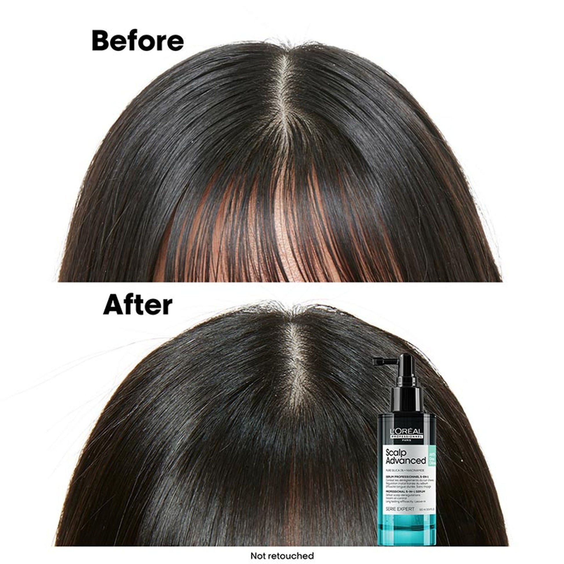 L'Oréal Professionnel Scalp Advanced 5-in-1 Professional Leave-in Serum for Scalp Care