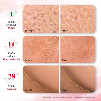 Olay Ultra Firming Serum - Phca, Bakuchiol & Collagen Peptide