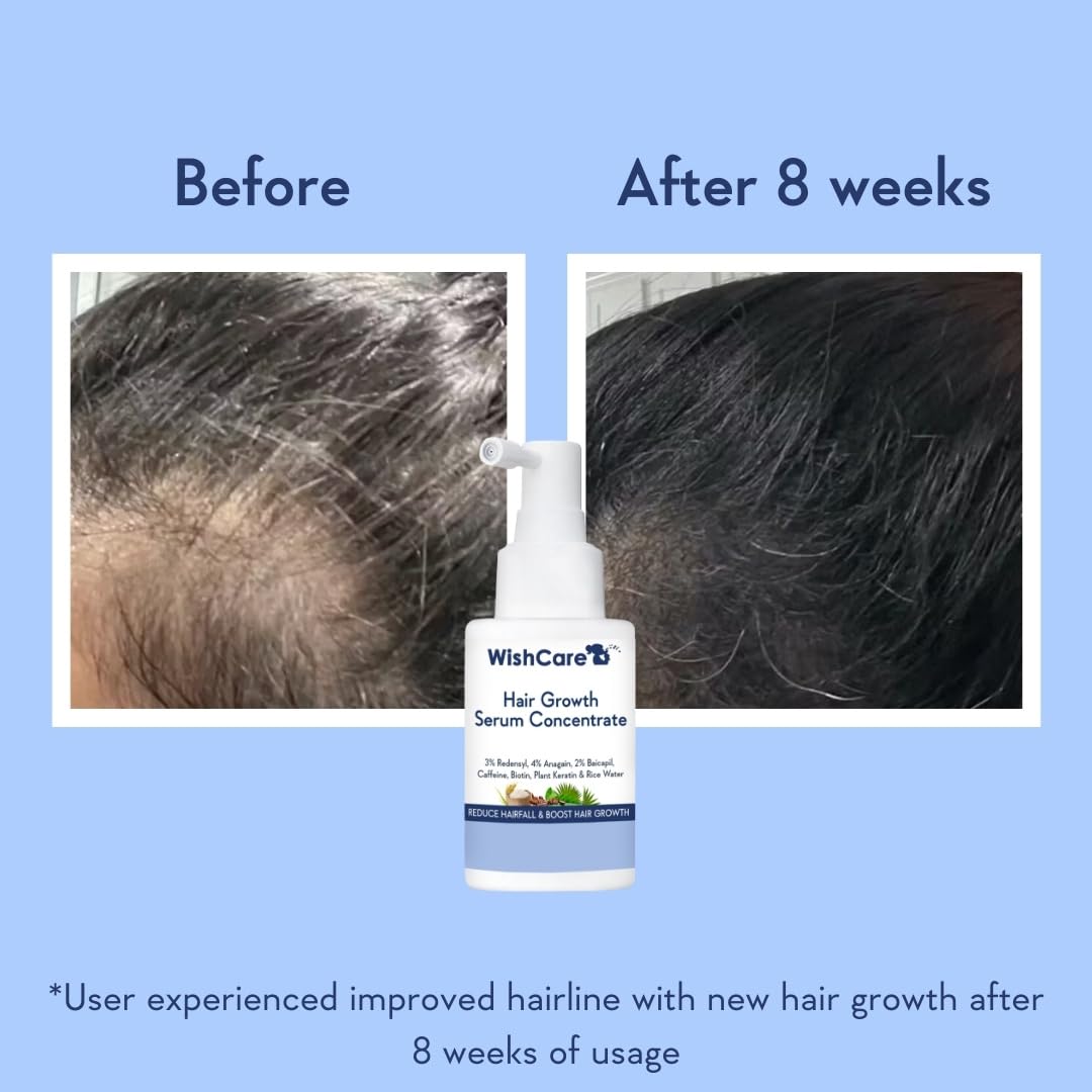 Hair Growth Concentrate Before & After 8 Weeks