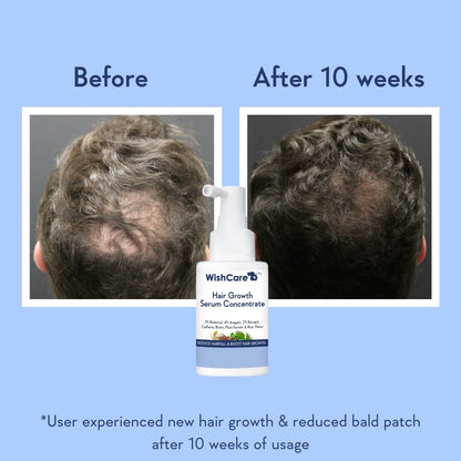 Hair Growth Before & After 10 weeks