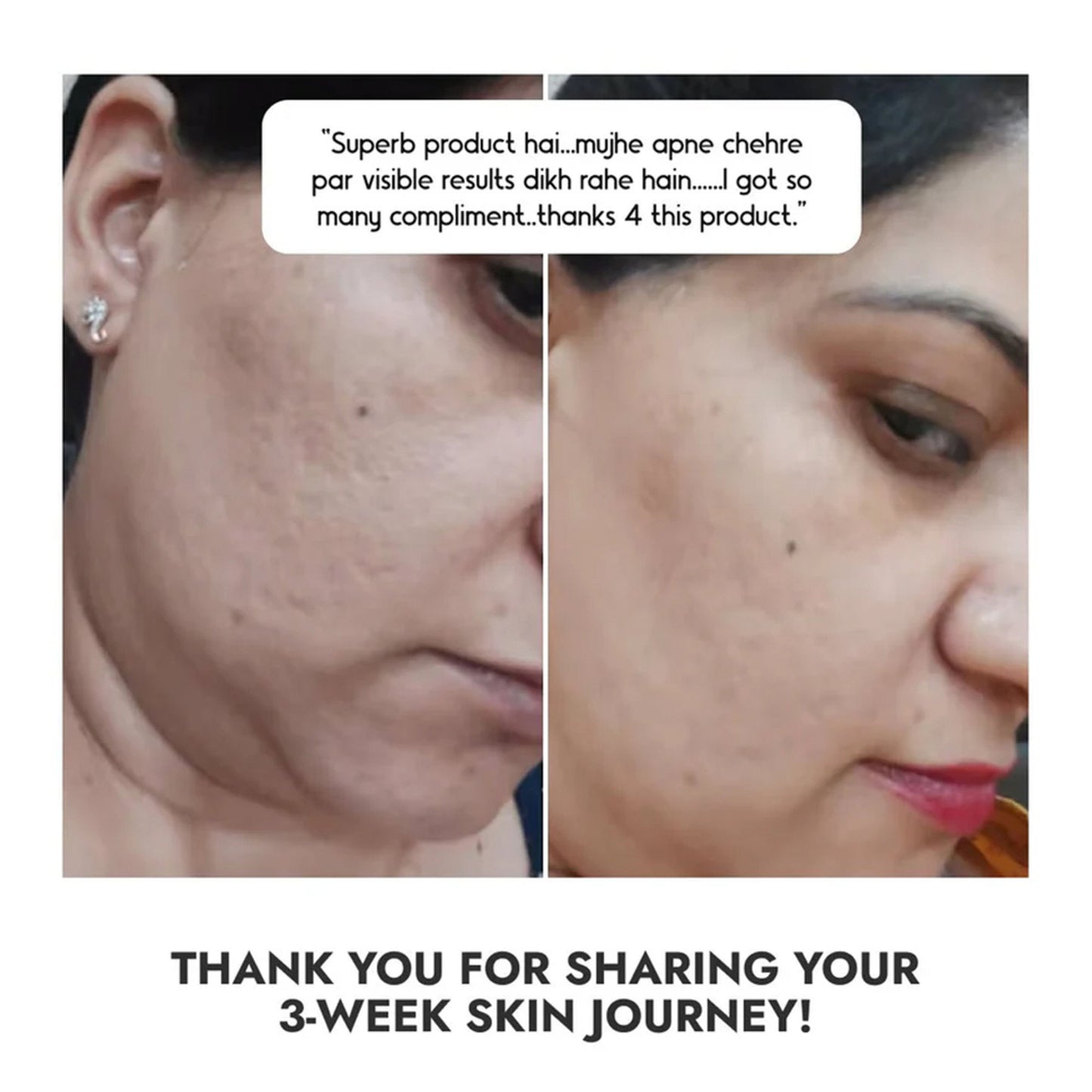 Cos-IQ Niacinamide Vitamin B3-10% Face Serum