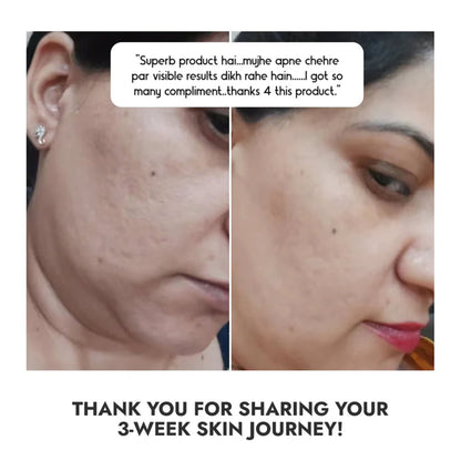 Cos-IQ Niacinamide Vitamin B3-10% Face Serum