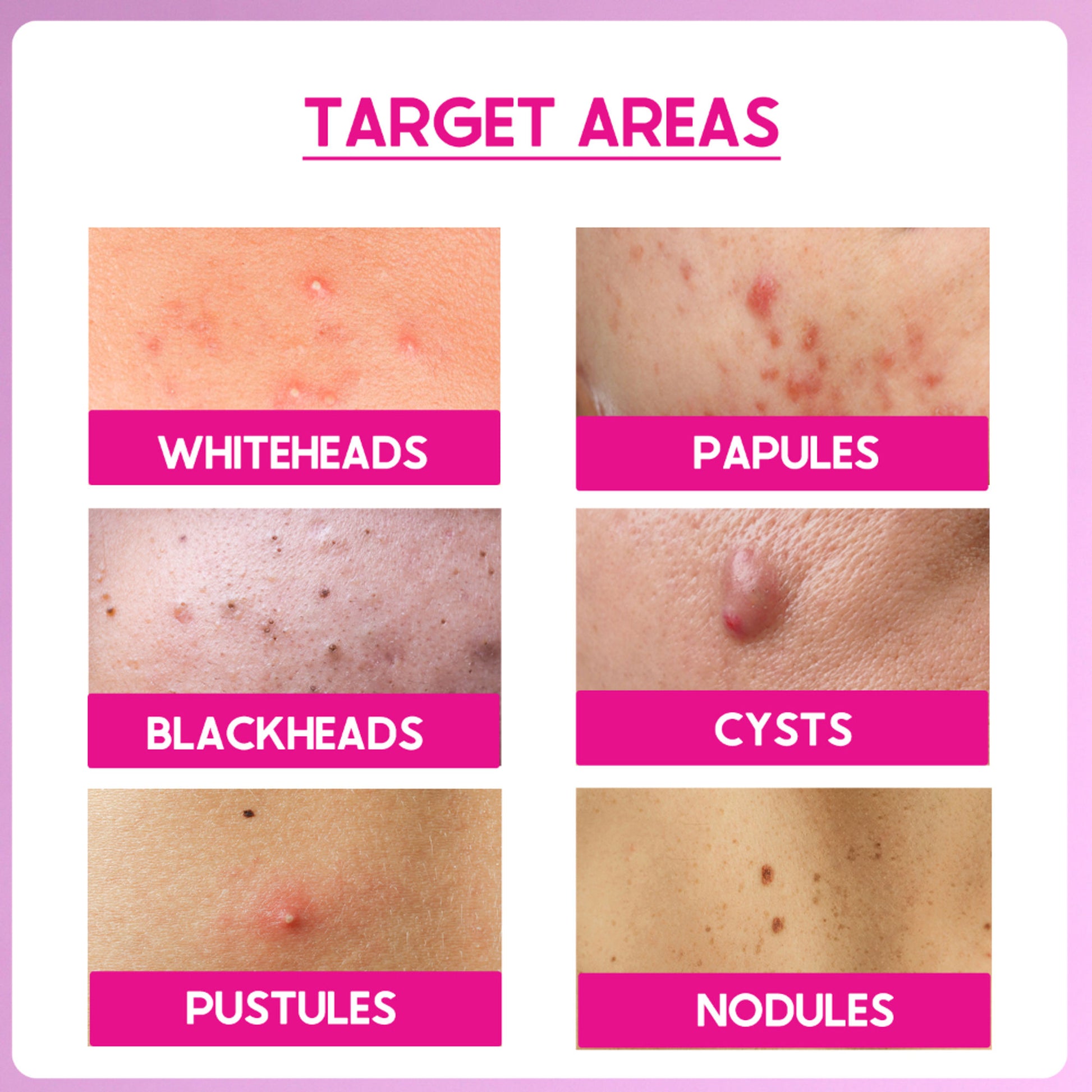 Cos-IQ Peel ABP-11% Exfoliate AHA + BHA + PHA Beginner Friendly Serum