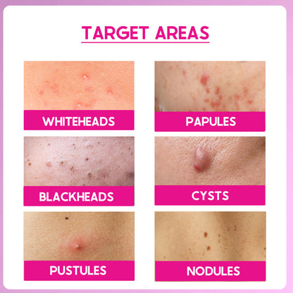 Cos-IQ Peel ABP-11% Exfoliate AHA + BHA + PHA Beginner Friendly Serum