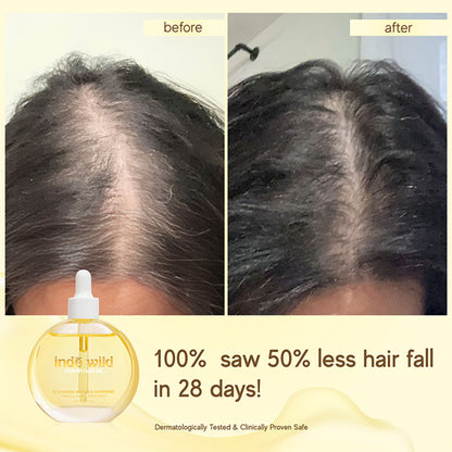inde wild Champi Hair Oil With Bhringraj, Brahmi & Amla For Regrowth, Hairfall & Dandruff Control