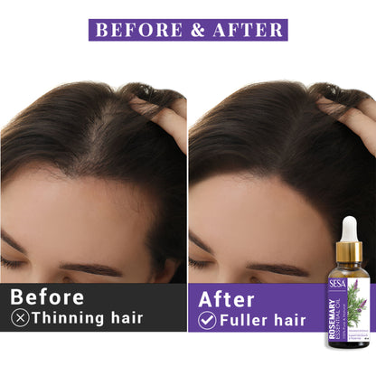 SESA Rosemary Essential Oil For Hair Growth