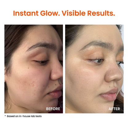 Foxtale Super Glow Moisturizer with Vitamin C & Niacinamide For Dull, Pigmented & Uneven Skin
