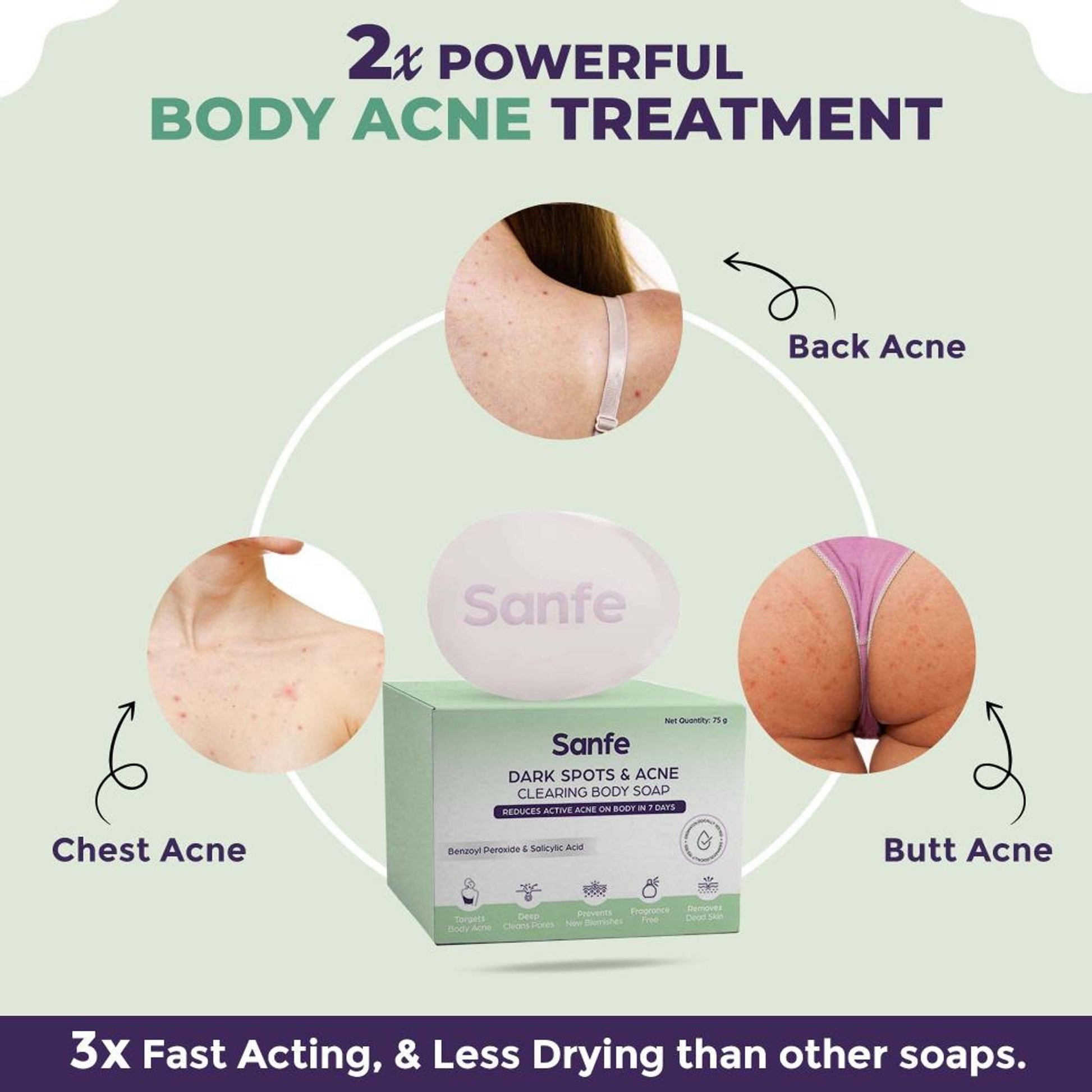 Sanfe Dark Spots & Acne Clearing Body Soap