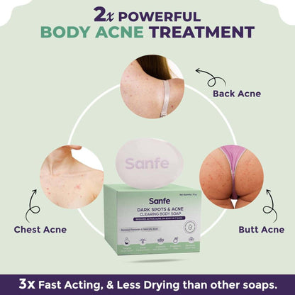 Sanfe Dark Spots & Acne Clearing Body Soap