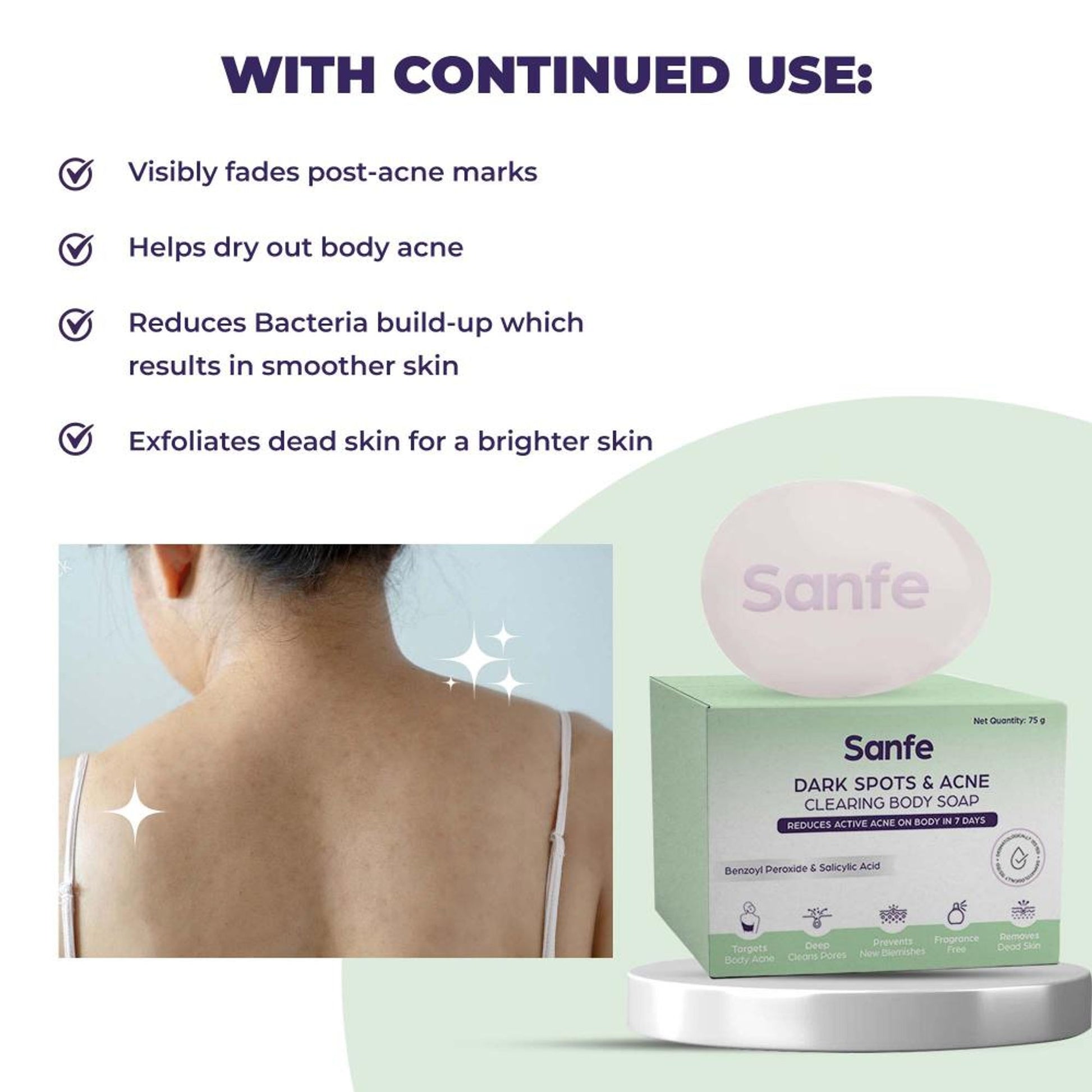 Sanfe Dark Spots & Acne Clearing Body Soap