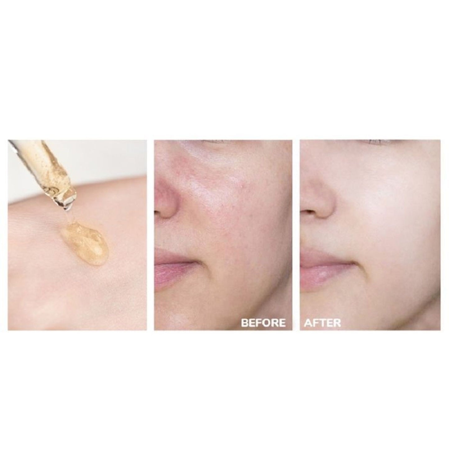 Mond'Sub Vitamin C Brightening Lifting Face Serum With (3-O Ethyl Ascorbic Acid) For Brightening