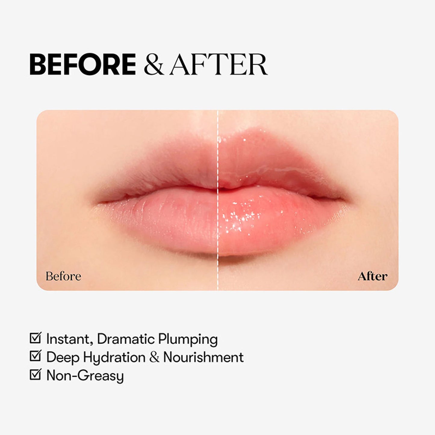 VT Cosmetics Reedle Shot Lip Plumper - Expert