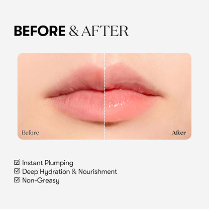 VT Cosmetics Reedle Shot Lip Plumper - Beginner