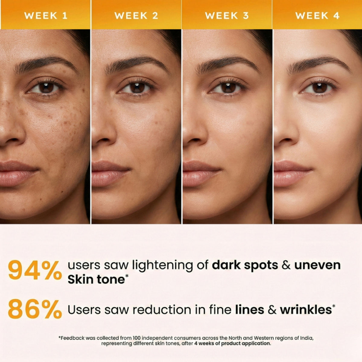 The Skin Story Anti Pigmentation Face Serum For Brighter Skin, Dark Spots, Niacinamide Alpha Arbutin
