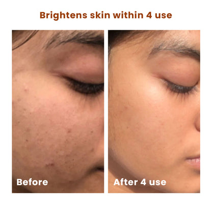 The Skin Story Salicylic Acid Brightening Face Scrub Removes Tan Excess Oil Blackheads & Whiteheads