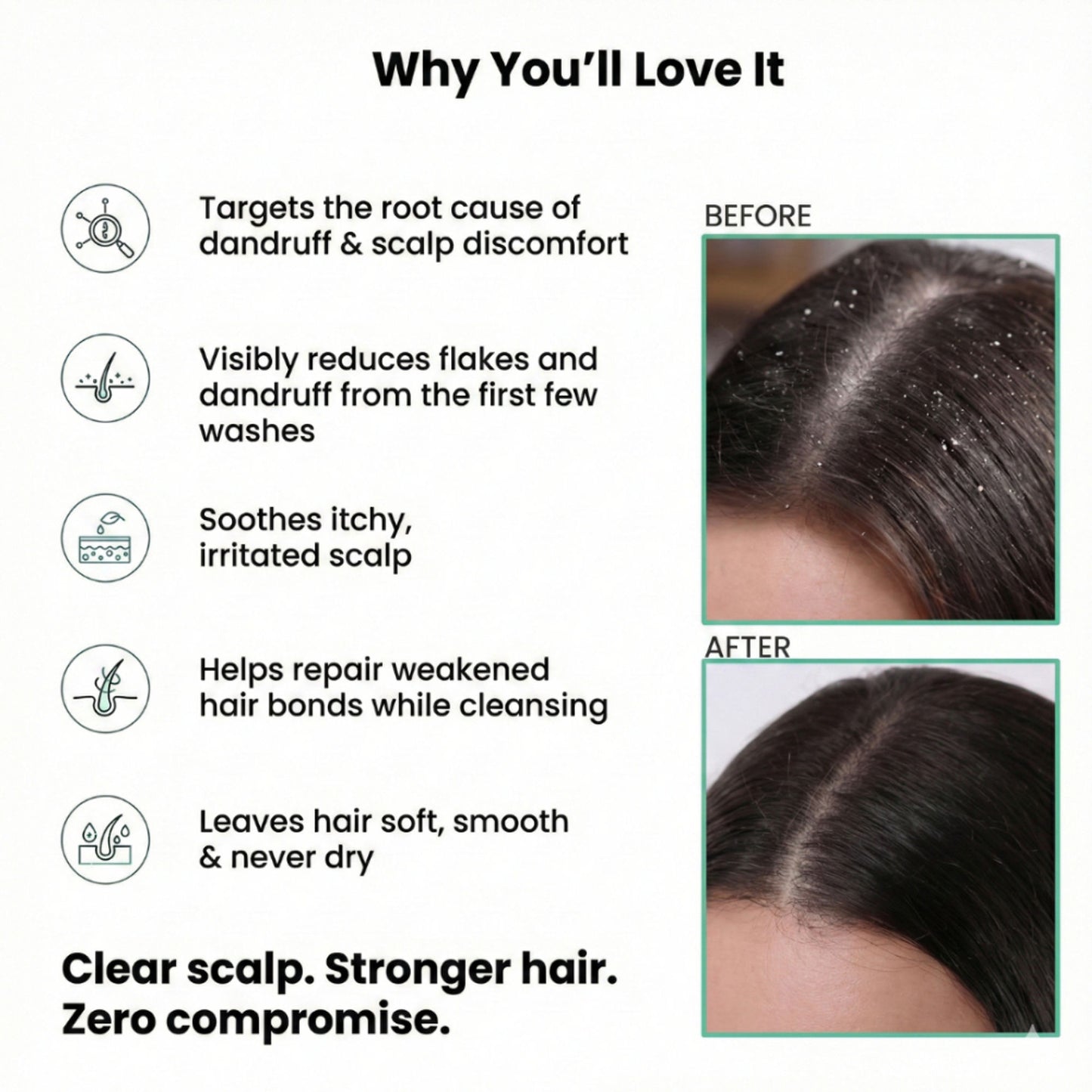 The Skin Story Anti Dandruff Deep Ceansing Shampoo Calms & Soothes Scalp With Saniscalp & Argan Oil