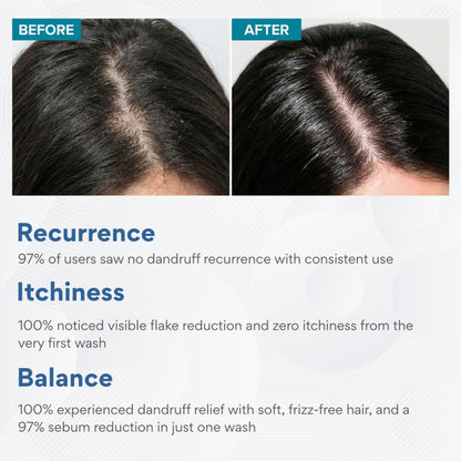 The Skin Story Anti Dandruff Deep Ceansing Shampoo Calms & Soothes Scalp With Saniscalp & Argan Oil
