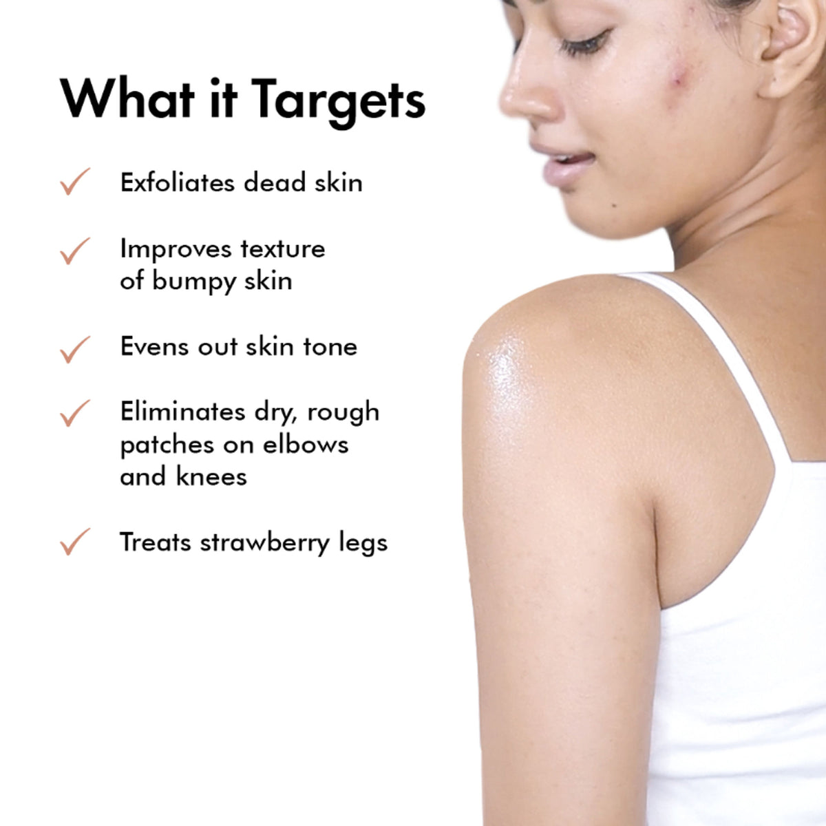 Suganda Lactic Body Lotion with 5% LA, Improves Skin Texture + Reduce Strawberry Legs (Unscented)