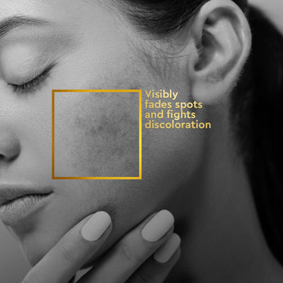 VLCC Clinic ProPerfect Spot Clarifying Face Wash