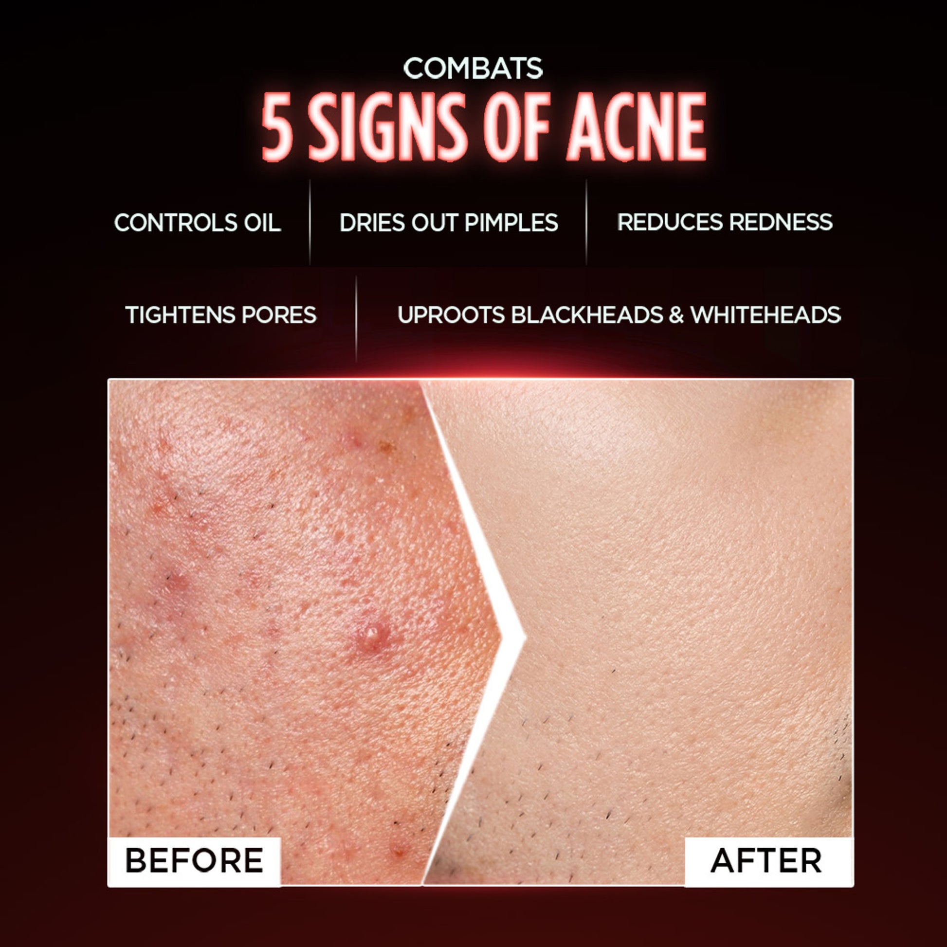 Garnier Men AcnoFight Anti Pimple Face Wash
