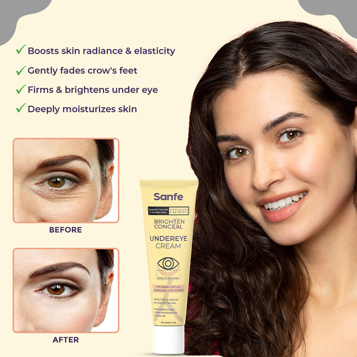 Sanfe Brighten & Conceal Undereye Cream, Dark Circles & Wrinkles Removal, Hyaluronic Acid & Collagen