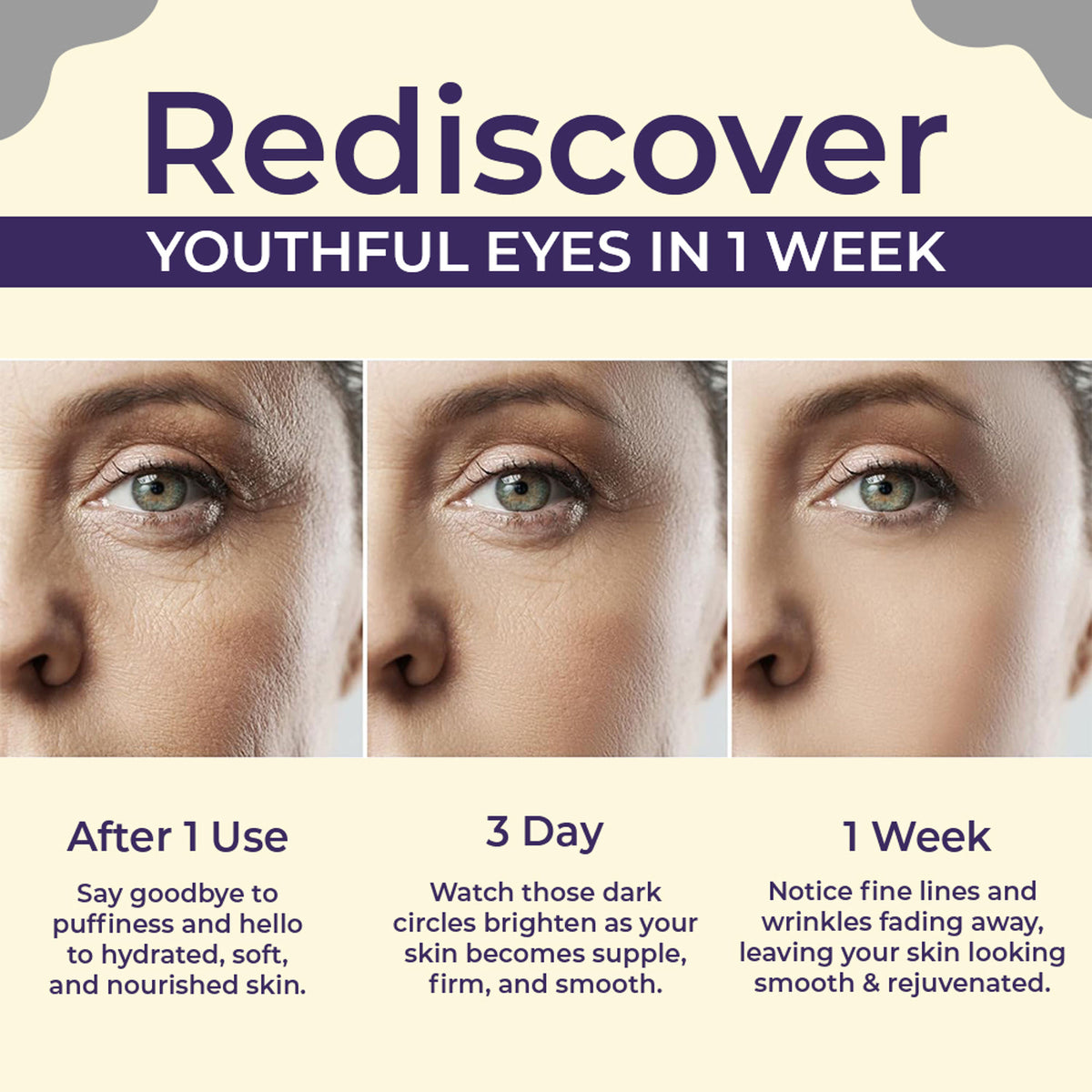 Sanfe Brighten & Conceal Undereye Cream, Dark Circles & Wrinkles Removal, Hyaluronic Acid & Collagen