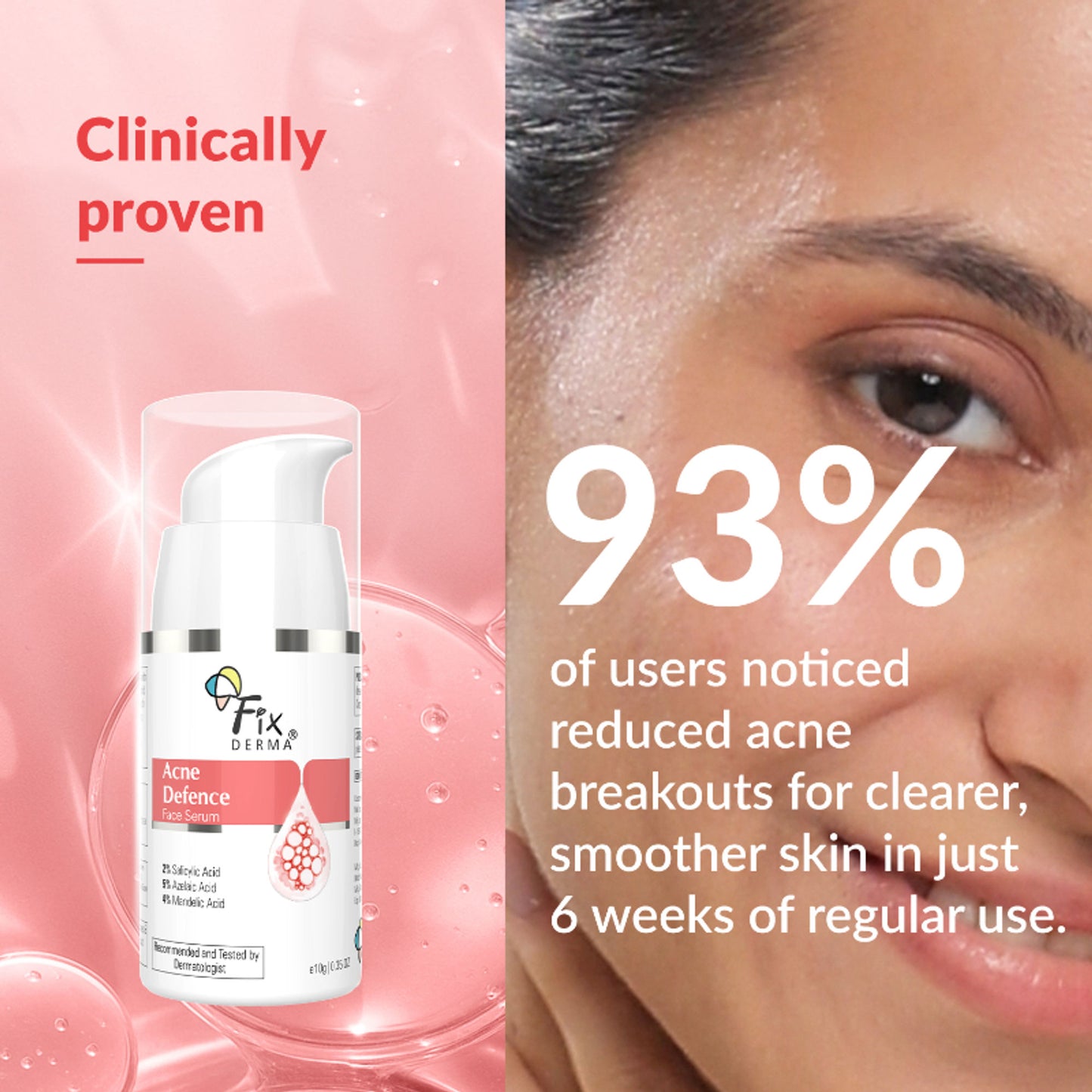 Fixderma Acne Defence Face Serum with 2% Salicylic Acid for Anti Acne & Spot Treatment
