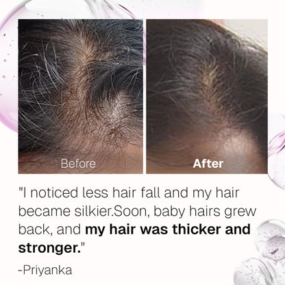 Bontress Pro+ Hair Serum With Tetrapeptides