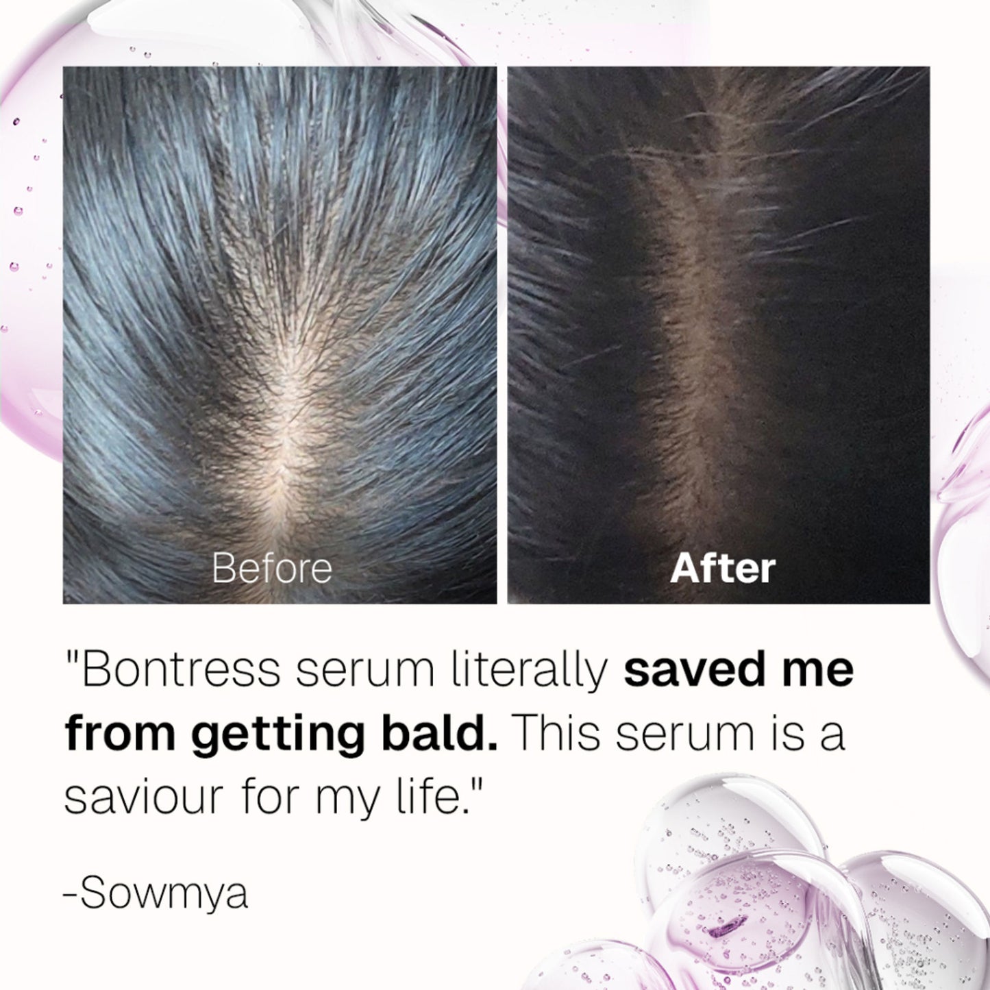Bontress Pro+ Hair Serum With Tetrapeptides