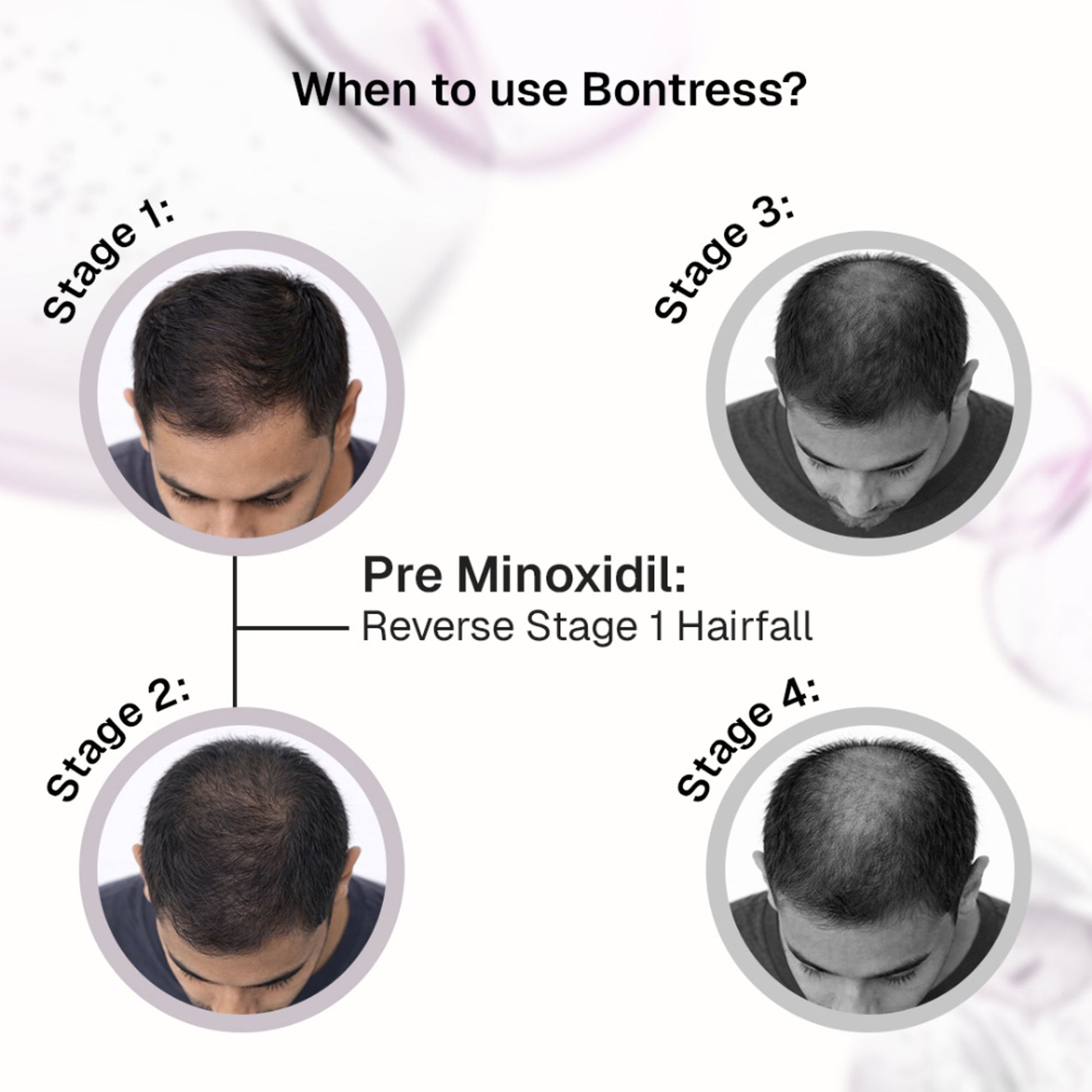 Bontress Pro+ Hair Serum With Tetrapeptides