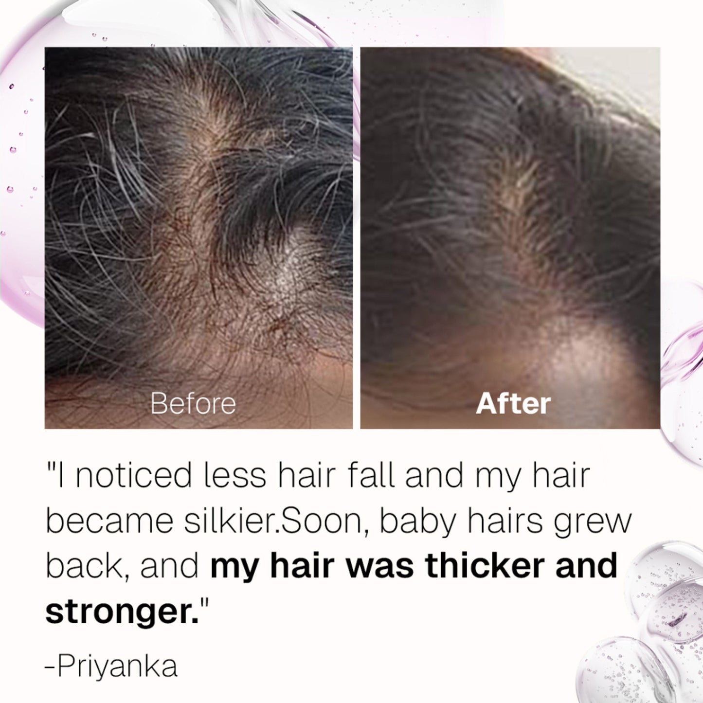 Bontress Pro+ Hair Serum With Tetrapeptides