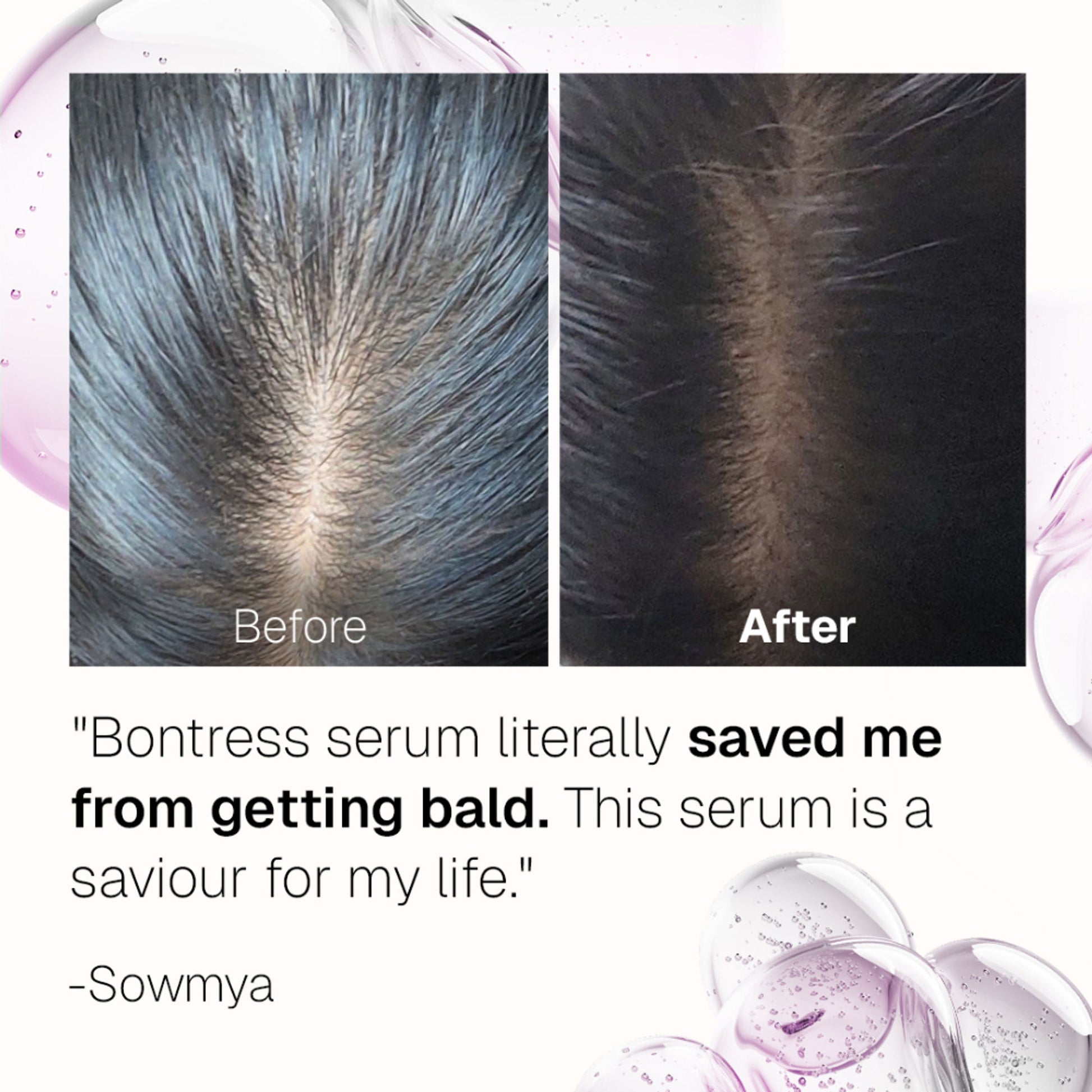 Bontress Pro+ Hair Serum With Tetrapeptides