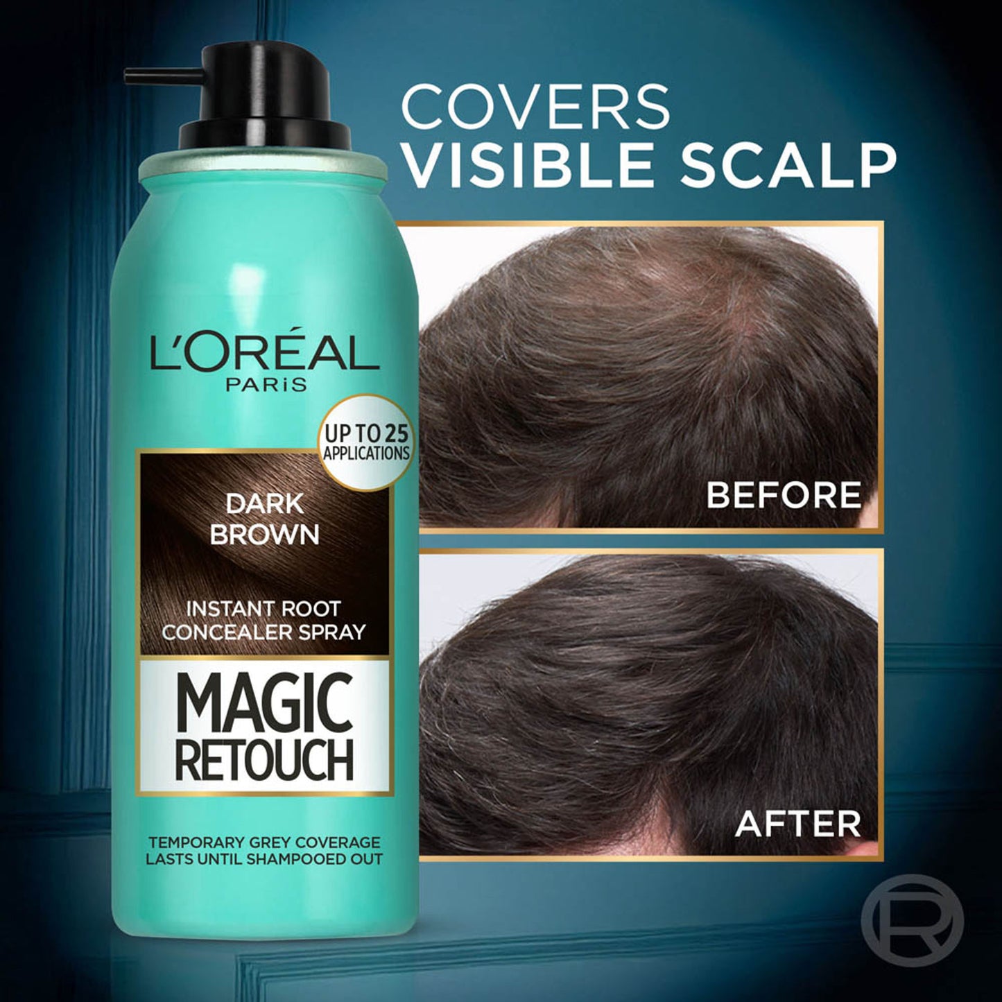 L'Oreal Paris Magic Retouch Instant Root Concealer Spray - Dark Brown