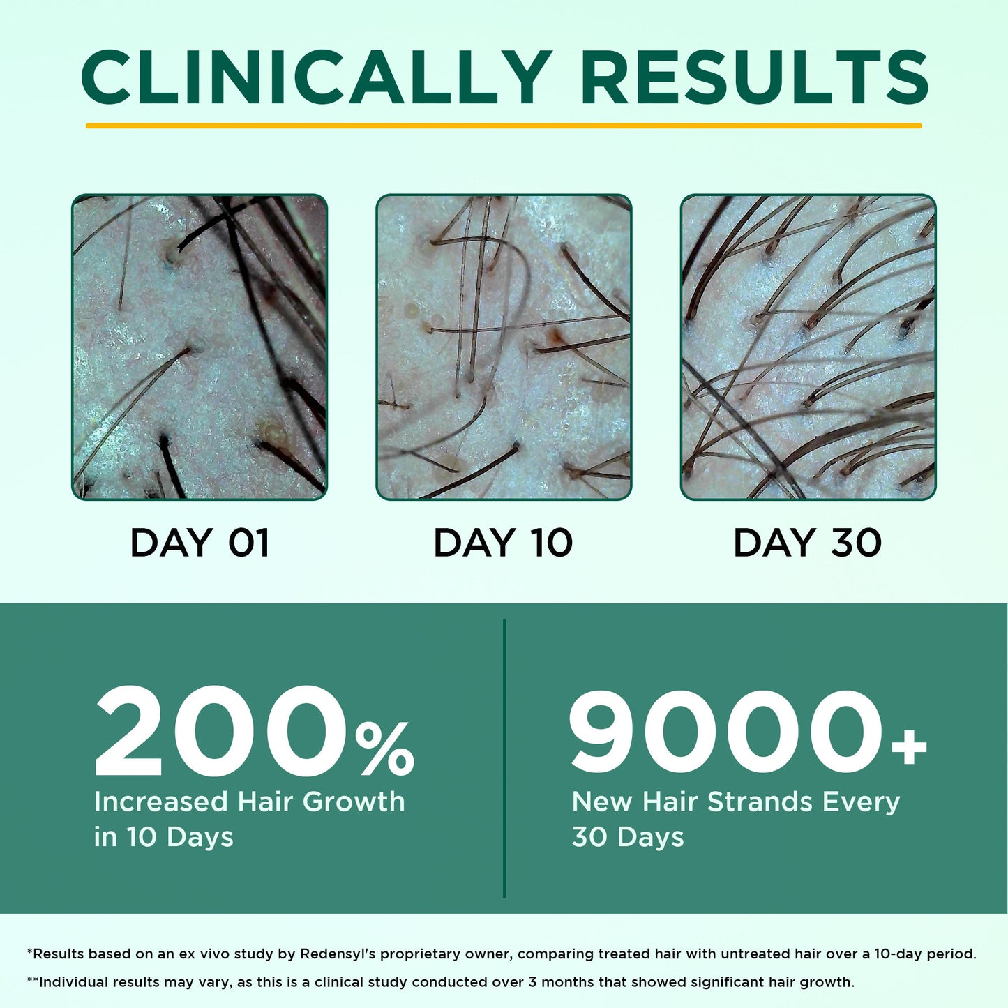 Orgatre Hair Growth Serum - 3% Redensyl, 4% Anagain, Castor & Rosemary Oil For Hairfall Control