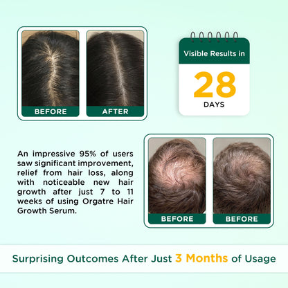 Orgatre Hair Growth Serum - 3% Redensyl, 4% Anagain, Castor & Rosemary Oil For Hairfall Control