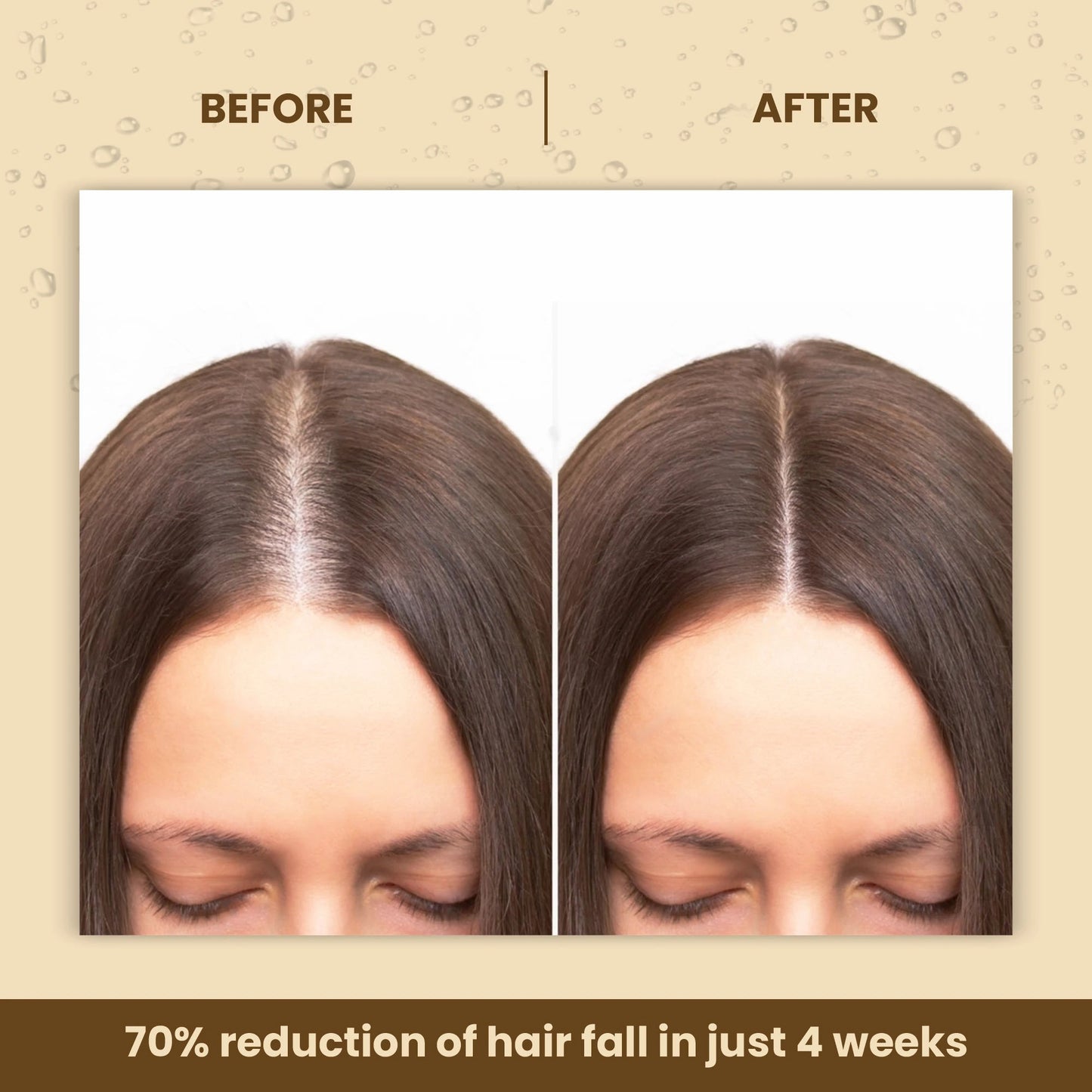 La Pink Methi Dana 8 In 1 Hair Growth Oil Boosts Hair Growth Thickness Controls Hair Fall