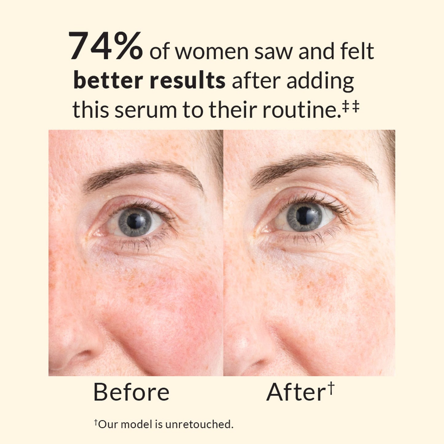 Avon Anew Skin Renewal Power Serum