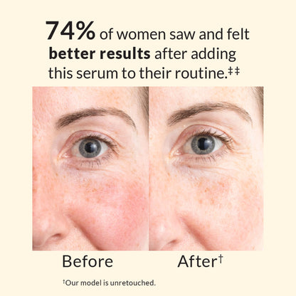 Avon Anew Skin Renewal Power Serum