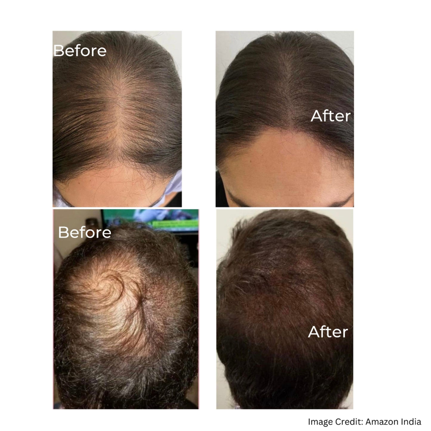 GLAD I MET YOU Hair Growth Serum
