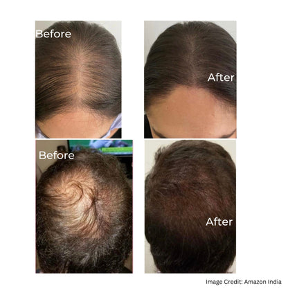 GLAD I MET YOU Hair Growth Serum