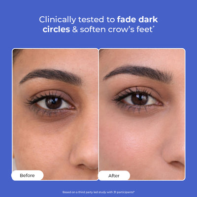 Conscious Chemist Retinol Peptide Under Eye Contour Treatment Serum For Dark Circles & Puffines
