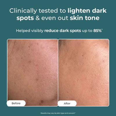 Conscious Chemist Pigmentation Corrector Cream For Dark Spots Remover & Uneven Skin Tone